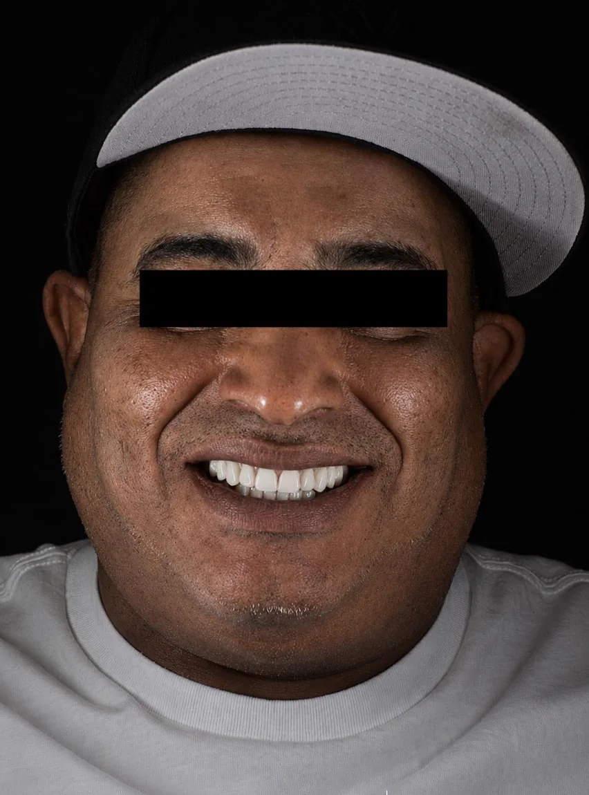 Patient 5 after treatment
