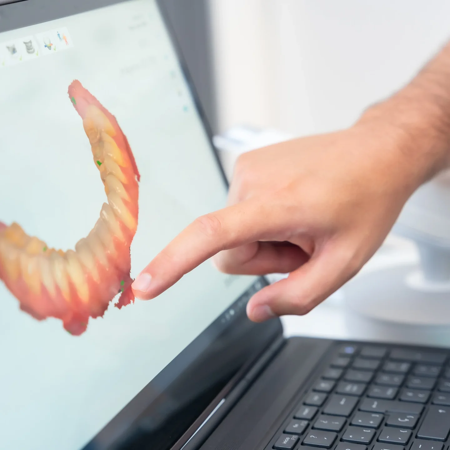 A full-arch denture design open on a screen