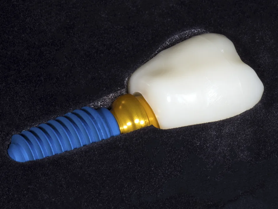 A single dental implant with its crown, on black