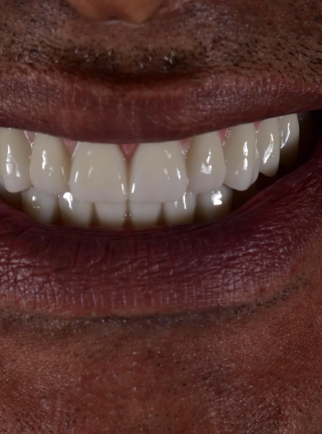 Patient 6 after treatment