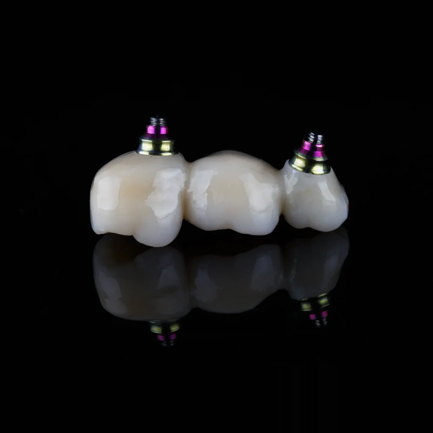 An implant bridge: joined crowns over two implants (model)