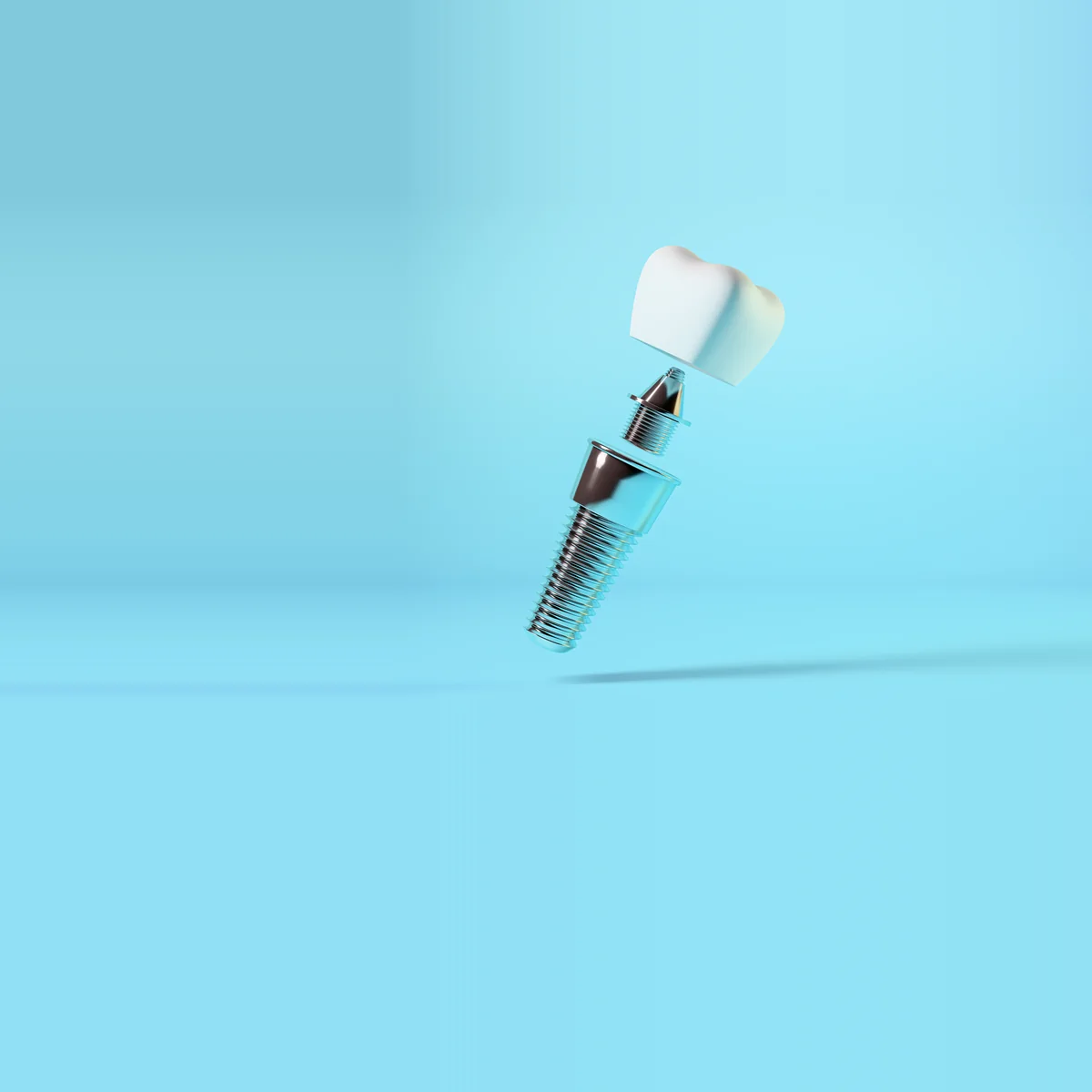 A dental implant, its abutment and its crown (model)