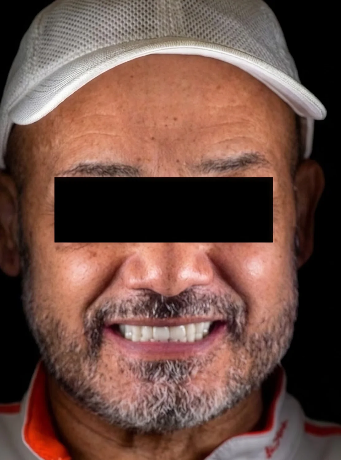 Patient 4 after treatment