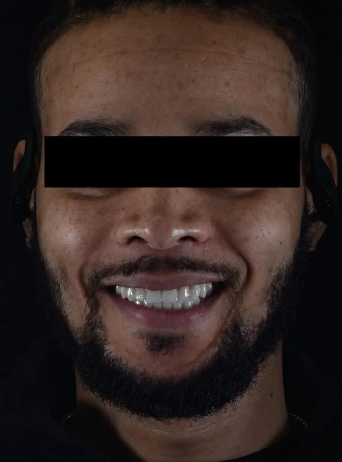 Patient 3 after treatment