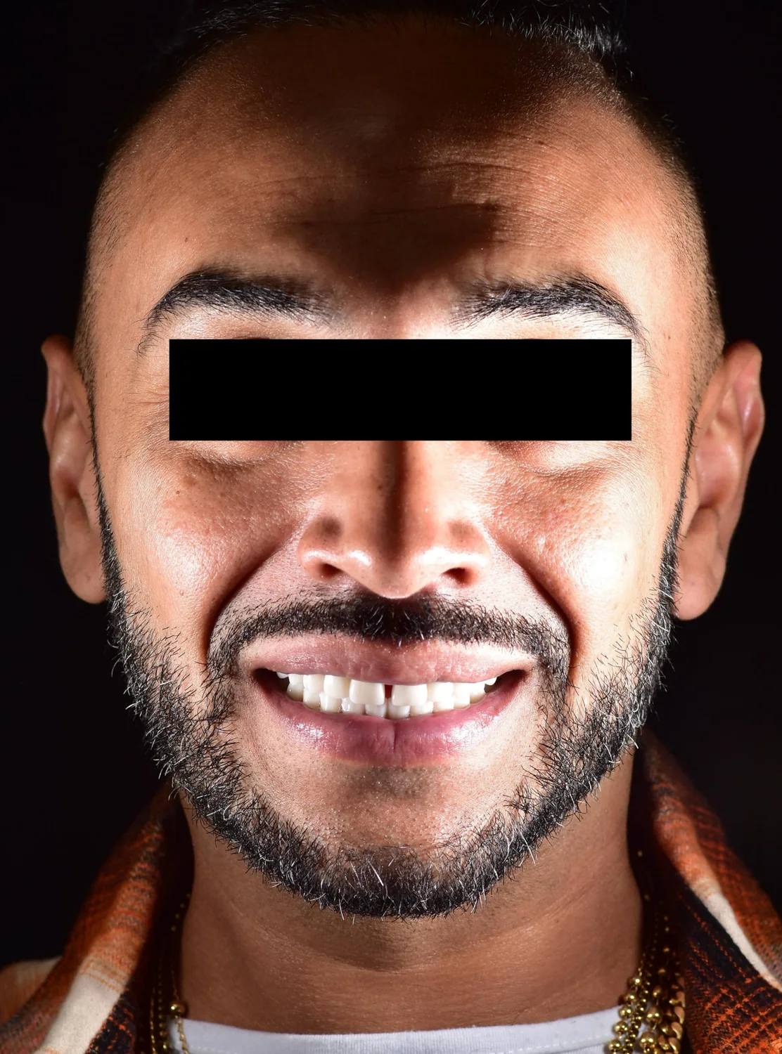 Patient 1 after treatment